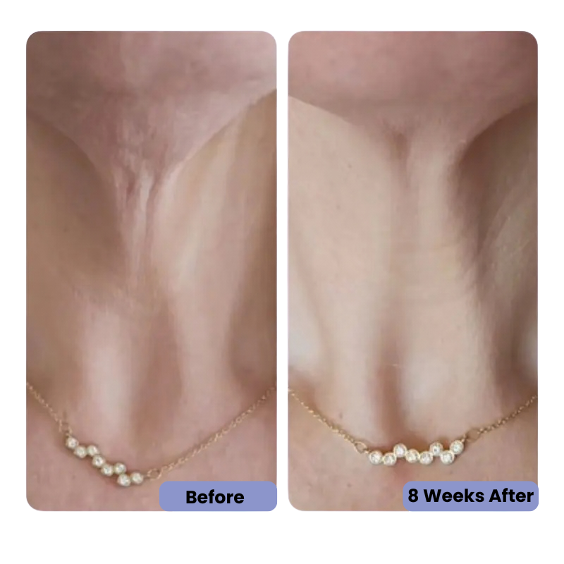 HerGlow™- Neck Cream