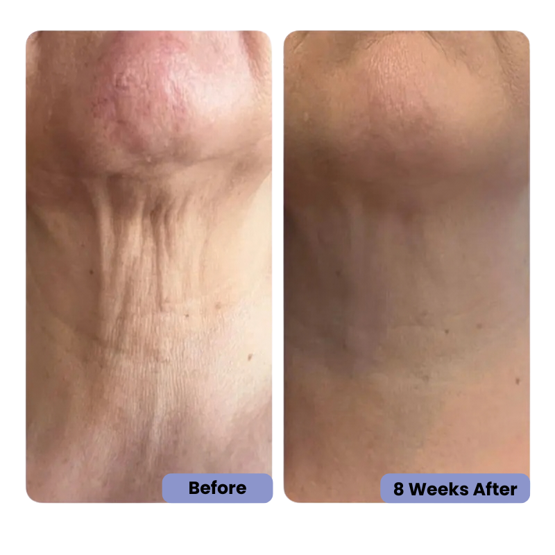 HerGlow™- Neck Cream
