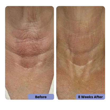 HerGlow™- Neck Cream